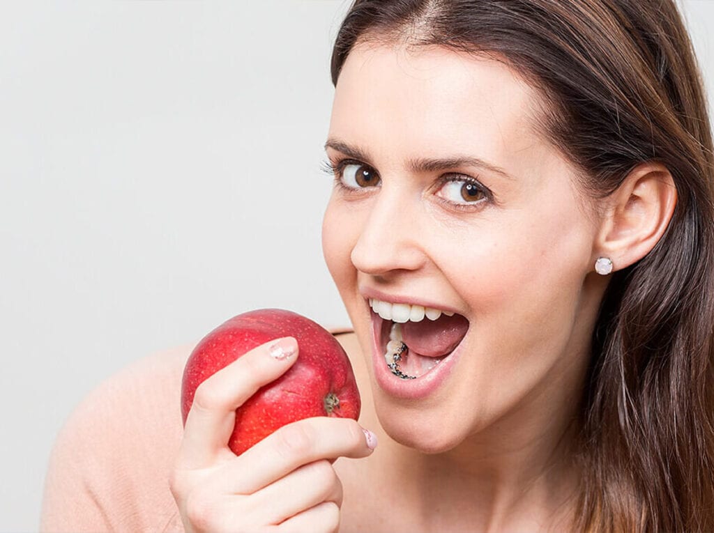 Frau mit zahnspange beisst in apfel